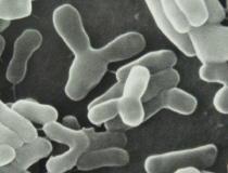 Bifidobacteria